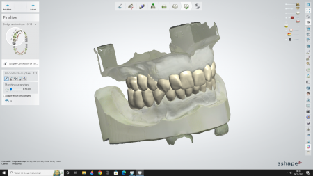 Plan 3D d'une prothèse dentaire présentée au salon ARIA
